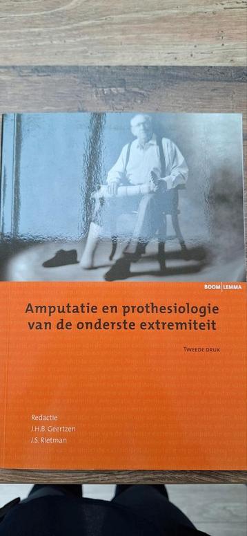 Amputatie en prothesiologie van de onderste extremiteit