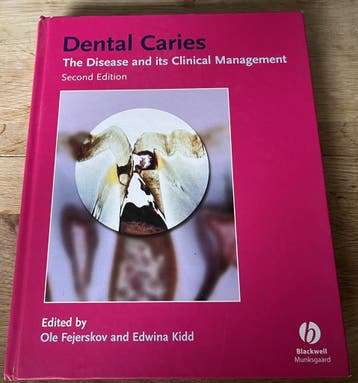 Dental caries Fejerskov Kidd 2nd edition