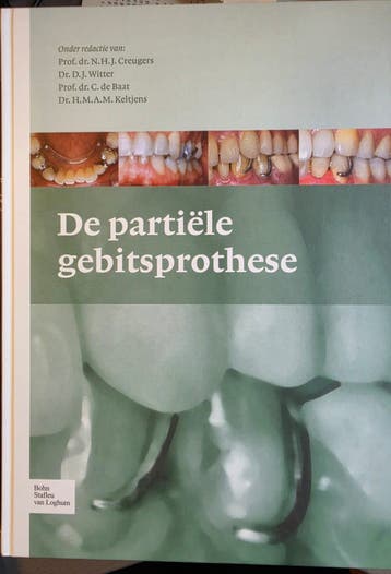 De partiële gebitsprothese - Tandheelkunde studieboek