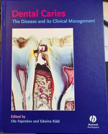 Dental Caries: The Disease and its Clinical Management